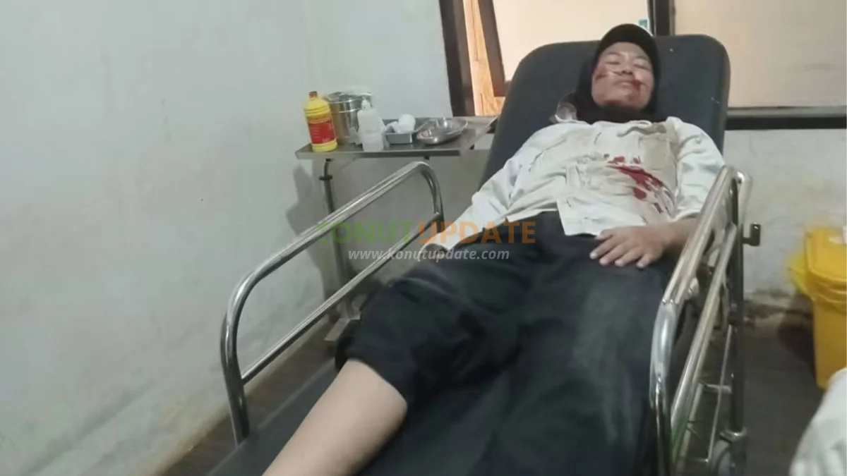 Kecelakaan Tunggal di Depan Pertamina Lahimbua, Pengendara Motor Alami Luka Serius